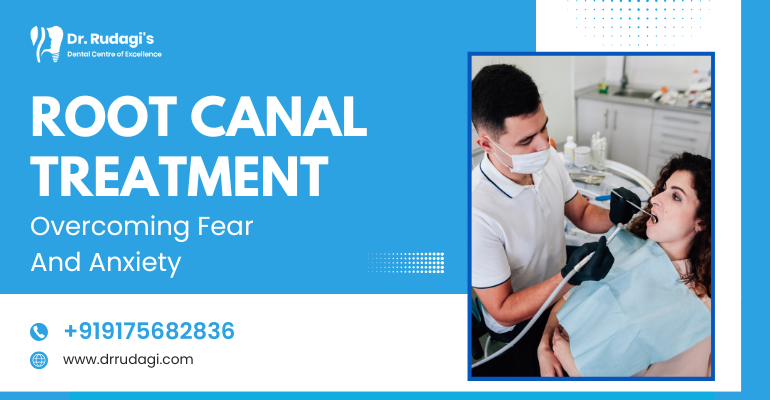 root canal treatment