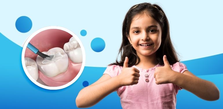 Fluoride & Dental Sealants