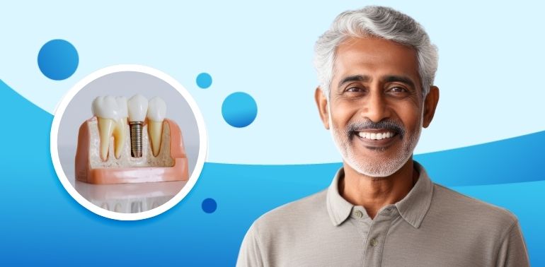 Dental Implant