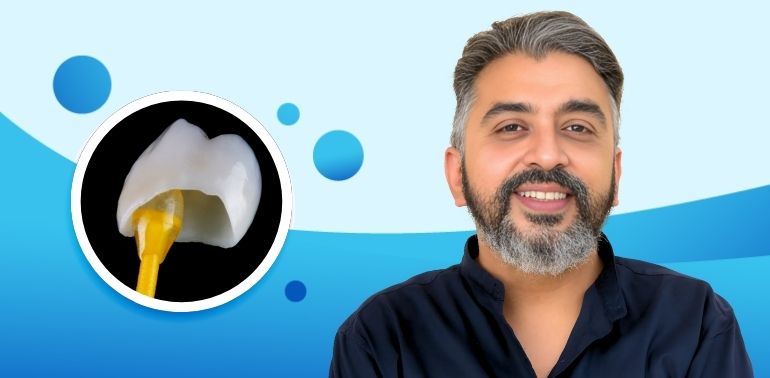 Dental Crown & Bridge