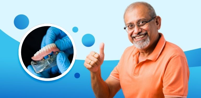 Overdentures