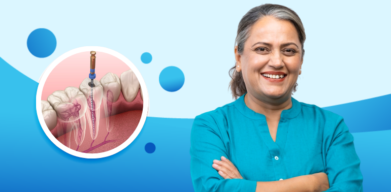 Root Canal Treatment