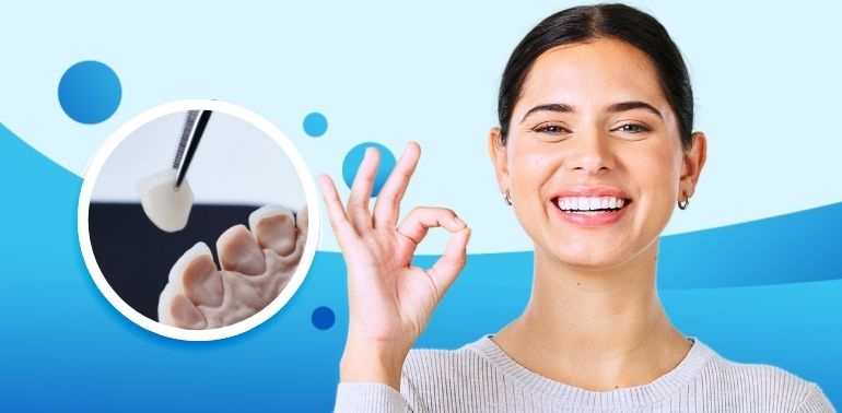 Smile Makeover