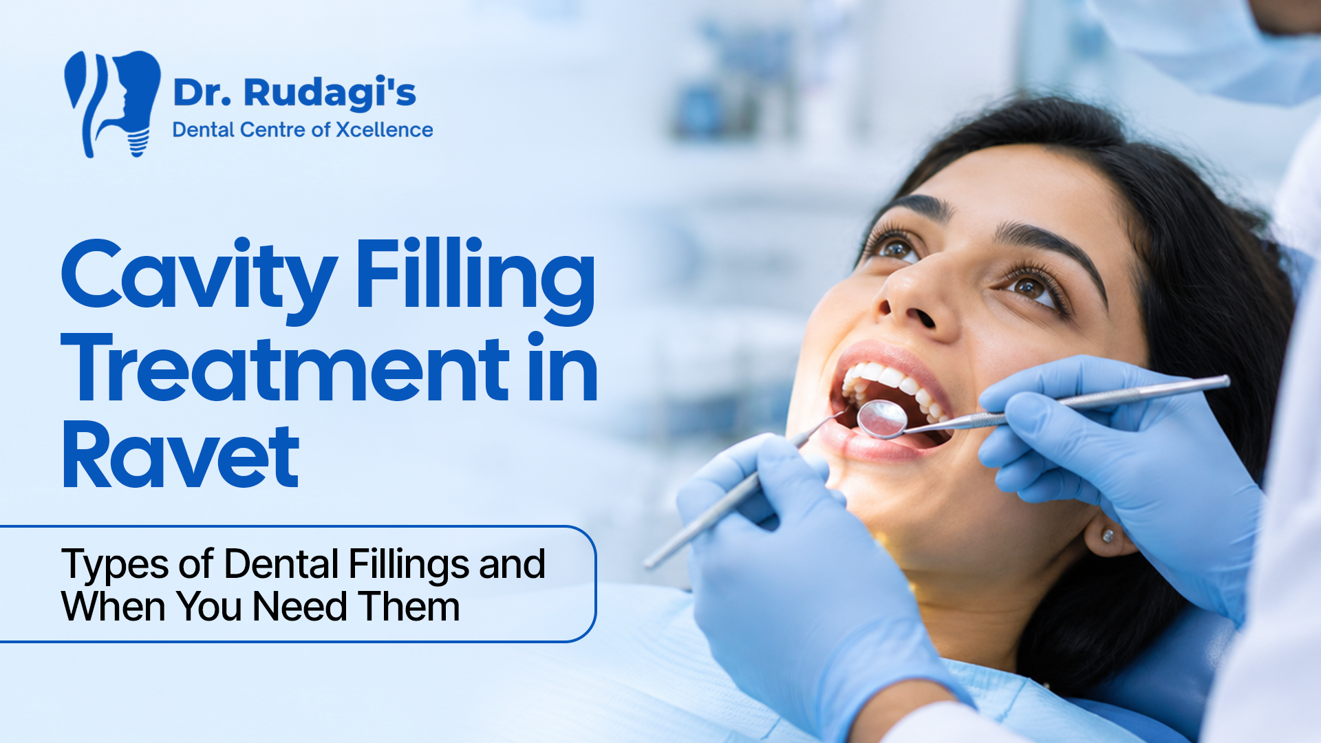 Cavity Filling Treatment in Ravet Types of Dental Fillings and When You Need Them
