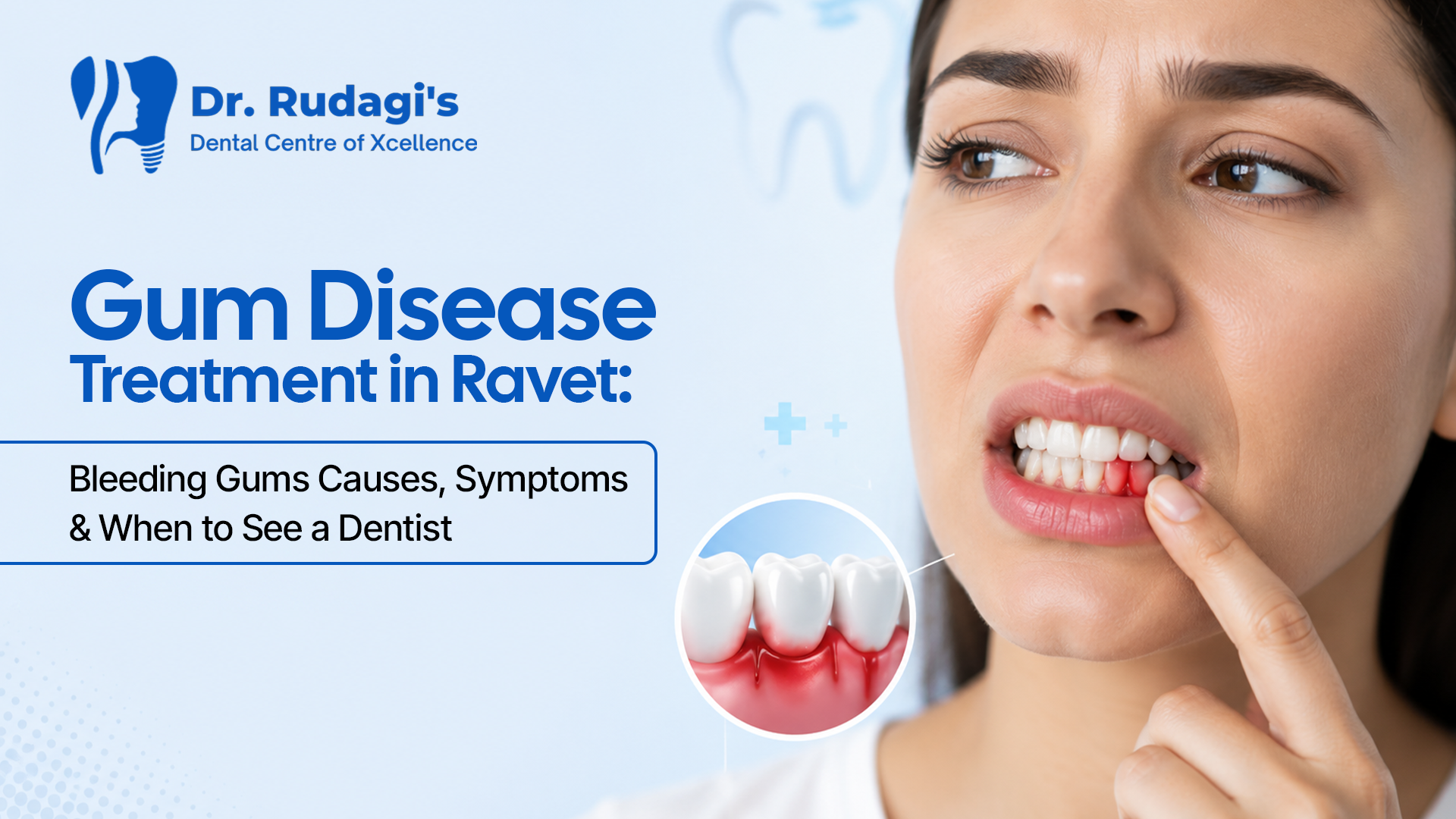 Gum Disease Treatment in Ravet – Bleeding Gums Causes, Symptoms & When to See a Dentist
