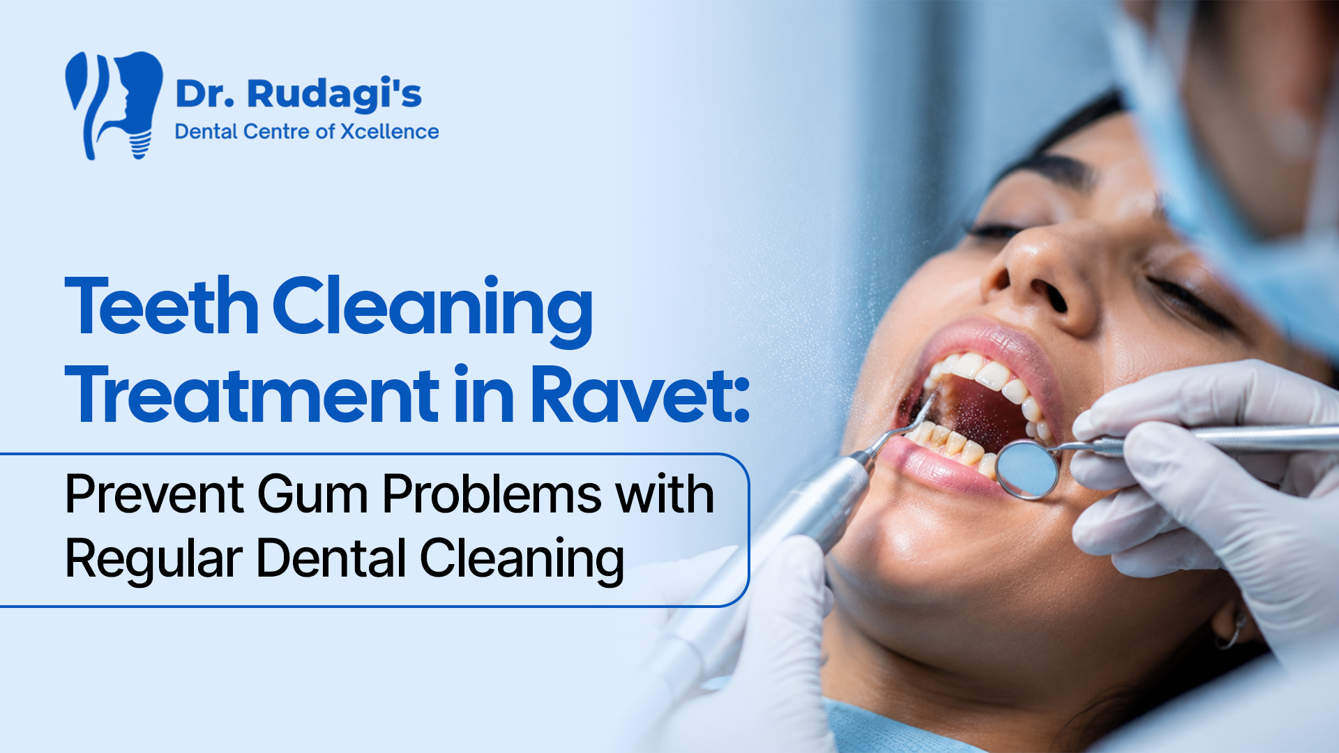 Teeth Cleaning Treatment in Ravet - Prevent Gum Problems with Regular Dental Cleaning